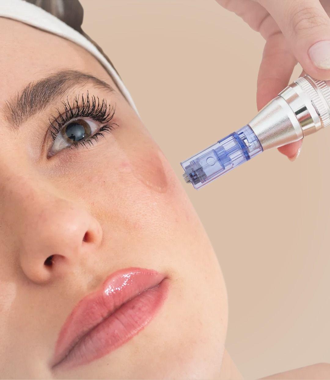 Dermapen Treatment
