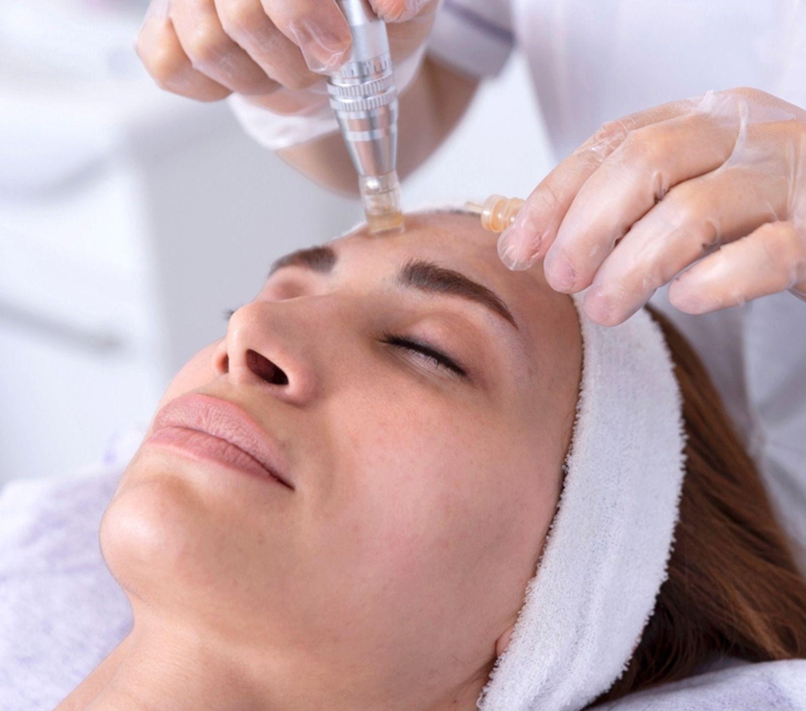 Dermapen Treatment