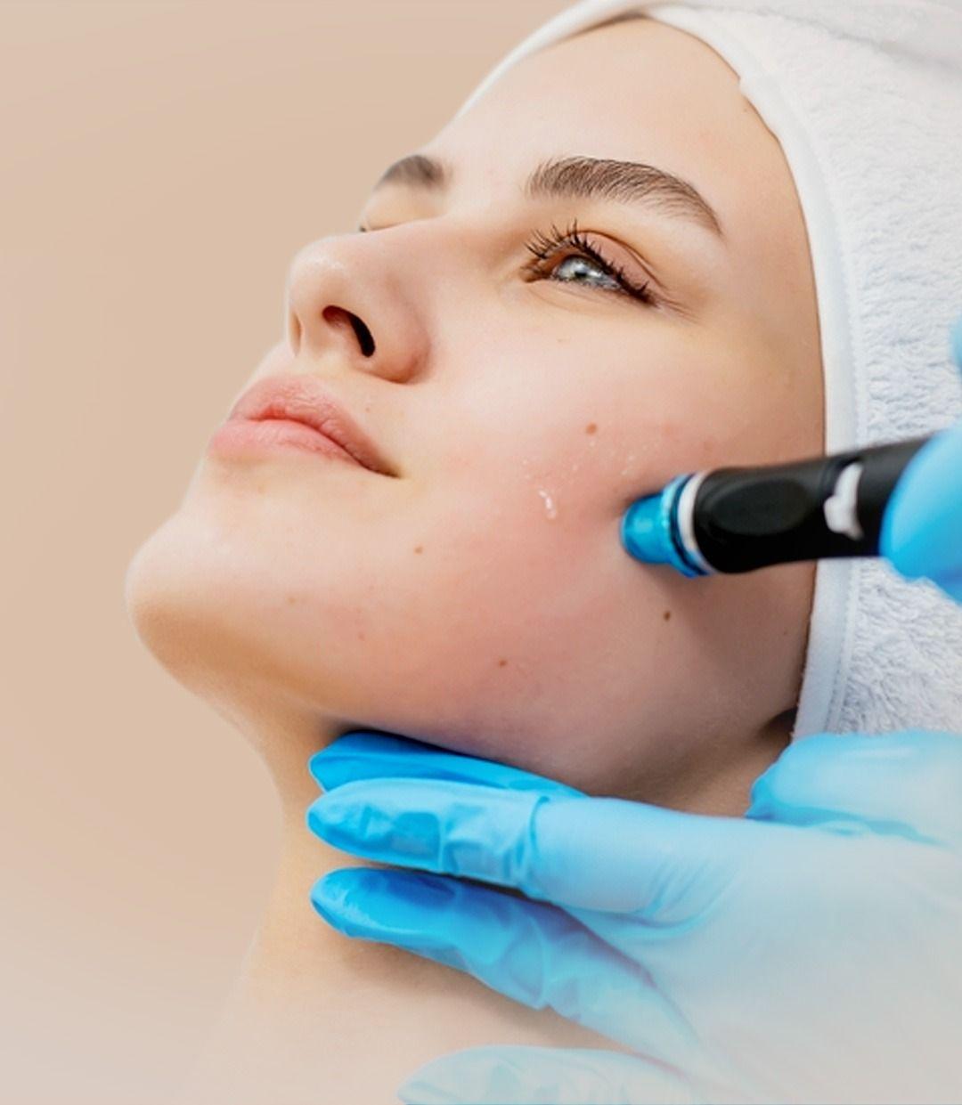Hydrafacial