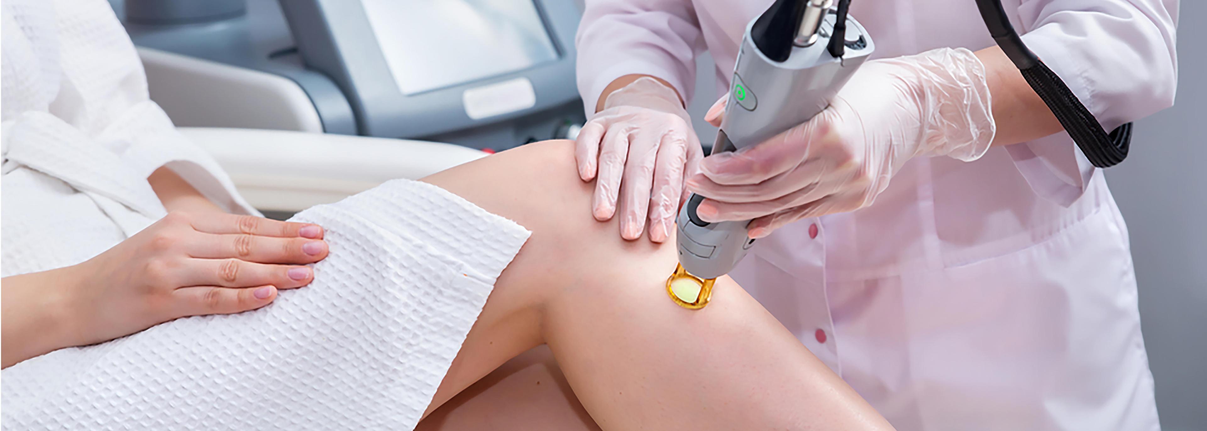 Laser Treatment