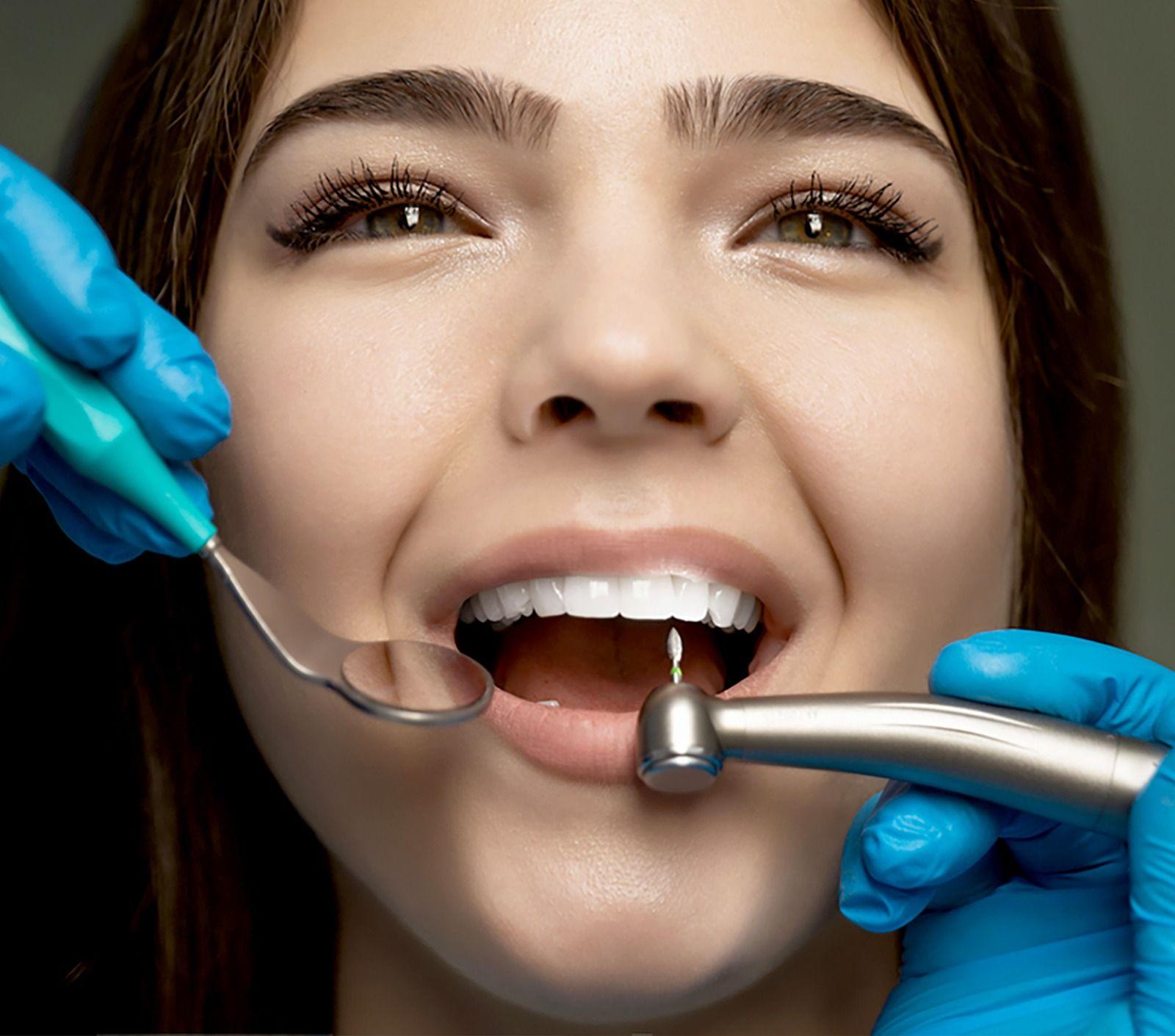 Root Canal Treatment