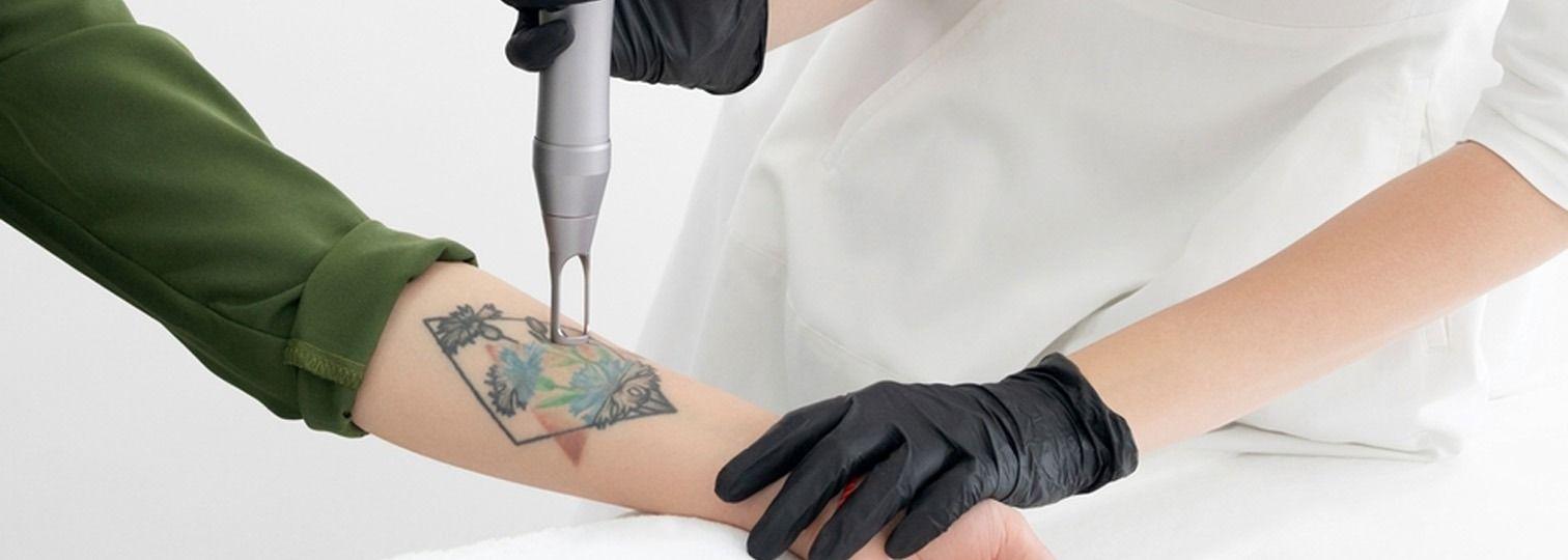 Laser Treatment