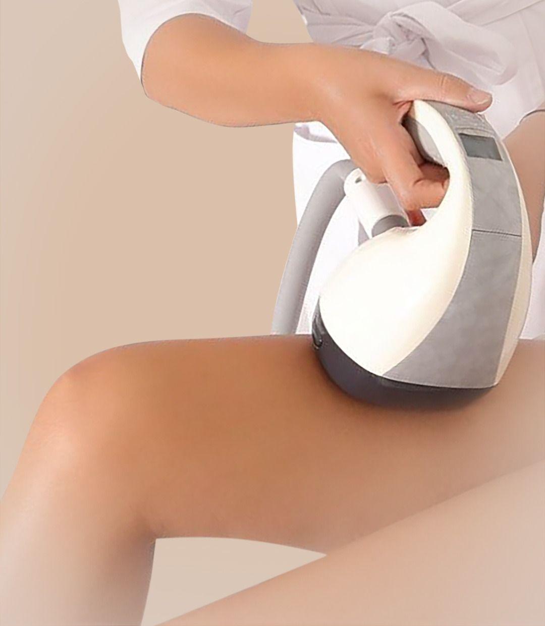 Velashape Treatment