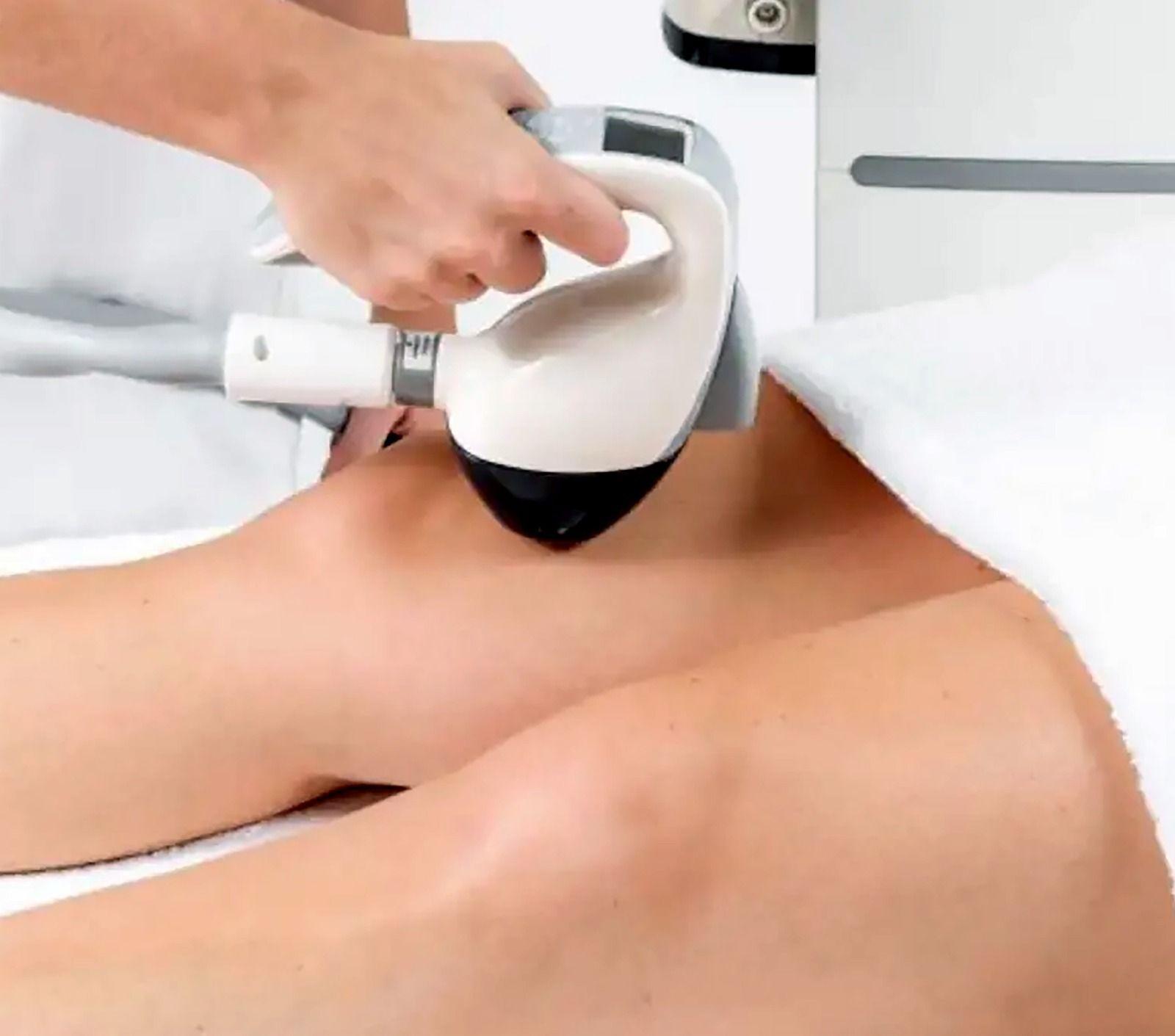 Velashape Treatment