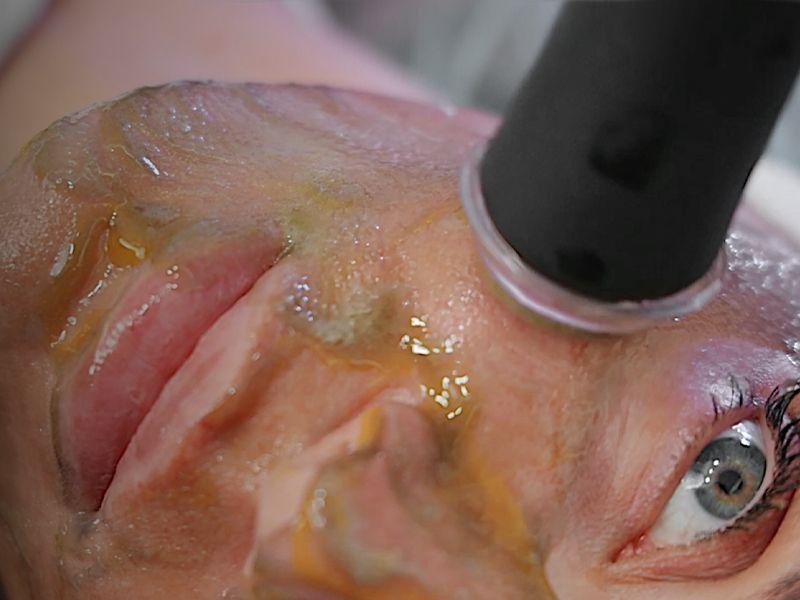 Facial Treatment